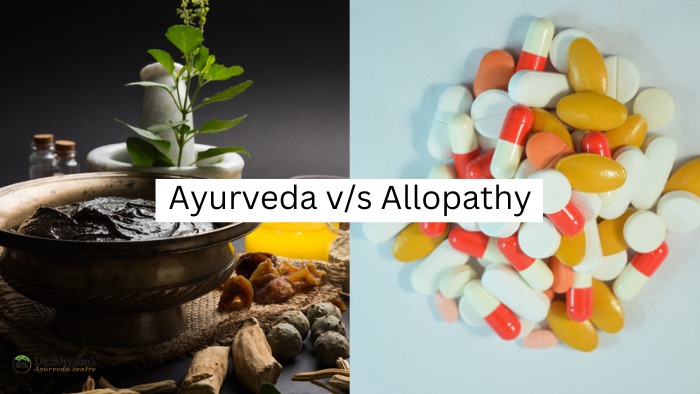 which is better treatment Ayurveda or Allopathy