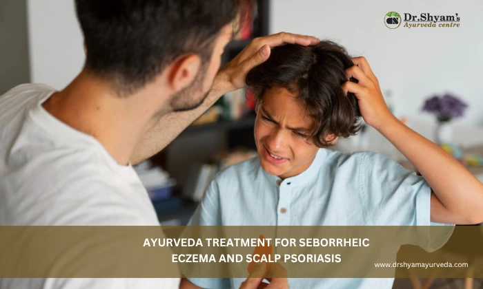Ayurveda Treatment for Seborrheic Eczema and Scalp Psoriasis