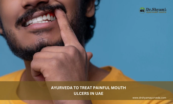 Ayurveda to Treat Painful Mouth Ulcers in UAE