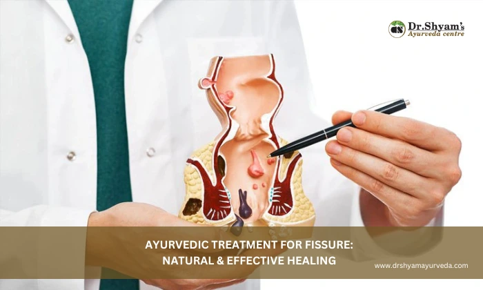 Ayurvedic Treatment for Fissure_ Natural & Effective Healing