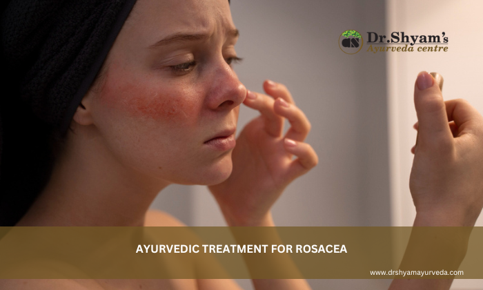 Ayurvedic Treatment for Rosacea