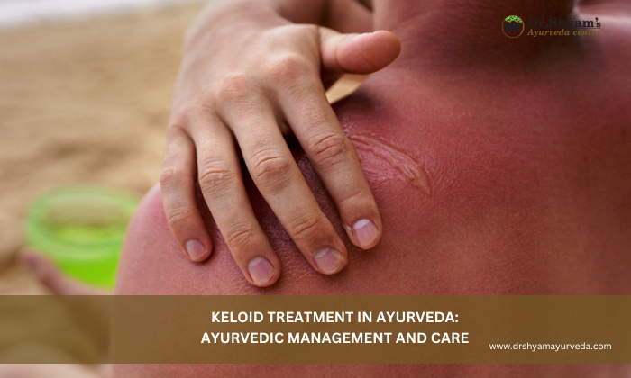 Ayurvedic Treatment for Plantar Fasciitis & Heel Pain