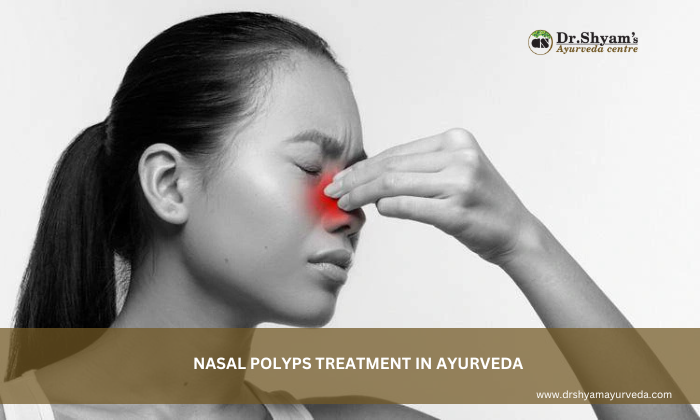 Nasal Polyps Treatment in Ayurveda