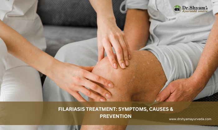 Filariasis Treatment: Symptoms, Causes & Prevention