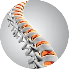 Scoliosis_lan